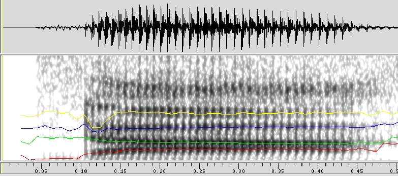 Acoustic analysis of the Thai syllable [da]